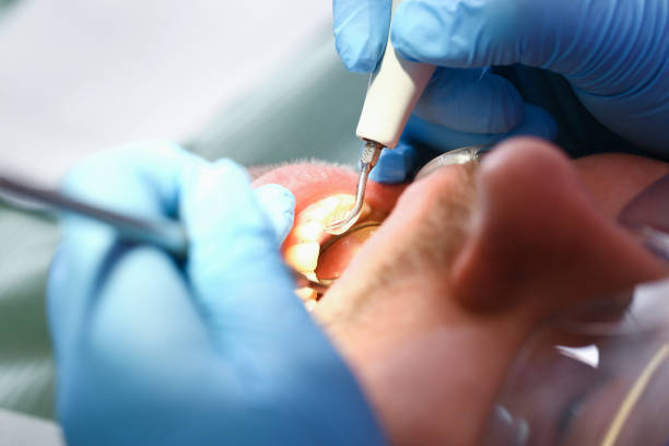 Best Emergency Dental Surgery in Ogden, KS