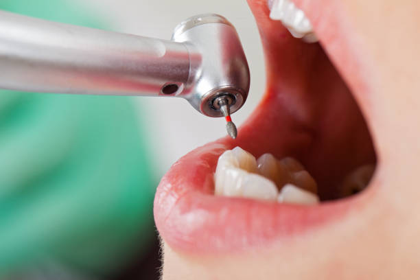 Best After-Hours Emergency Dentist in Ogden, KS